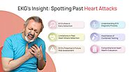 EKG's Insight: Spotting Past Heart Attacks