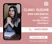 Best Skin Clinic in Chandigarh