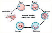 Blastocyst Meaning in Hindi | ब्लास्टोसिस्ट क्या है? | ब्लास्टोसिस्ट स्थानांतरण