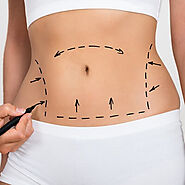 Liposuction in Dubai & Abu Dhabi | Best Liposuction Surgeons | AED 7,399+