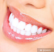 The Teeth Whitening Procedure in Dubai Clinics