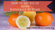 How To Get Rid Of Hives Naturally At Home
