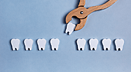 6 Things to Know About Getting a Dental Extraction