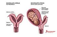 Bicornuate uterus : How does it affect your pregnancy - Health and Fitness Informatics