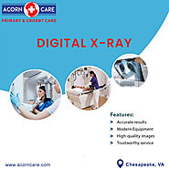 Get Digital x-ray Services near me in Chesapeake VA at Acorn Care