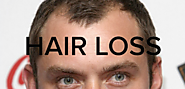 Men Hair Loss