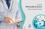 What Is the Process of Minimally Invasive Spine Surgery Operation?