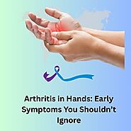 Arthritis in Hands: Early Symptoms You Shouldn’t Ignore - Herbal Care Products - Blog