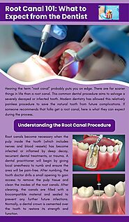 Root Canal 101: What to Expect from the Dentist