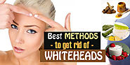 25+ Best Home Remedies to Get Rid of Whiteheads Fast - Beauty & Glamour Tips
