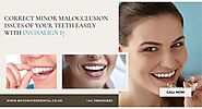 Correct minor issues of your teeth easily with Invisalign i7