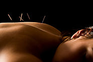 Acupuncture Massage Sydney – Wholistic Natural Medicine