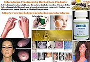 Natural Herbal Treatment for Scleroderma and Symptoms, Causes - Herbal Care Products Blog