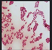 This is how our hero looks under a microscope