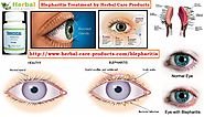 Natural Herbal Remedies for Blepharitis Eyelid