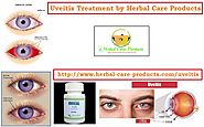 Uveitis Natural Remedies | Symptoms Causes and Natural Home Treatment - Herbal Care Products