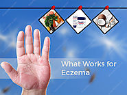 What work for eczema?