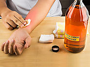 How To Control Dyshidrotic Eczema?