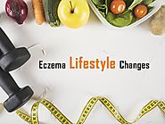 Eczema Lifestyle Changes - 12 Tips to Manage Severe Eczema