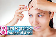 8 Ways to Get Rid of Forehead Acne Overnight