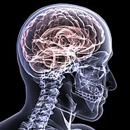 Neurological injuries unrelated to spinal cord damage.