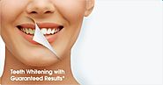 Teeth Whitening and Hygiene