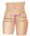 Ovarian cysts fact sheet