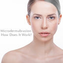 Microdermabrasion: How Does it Work?