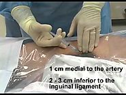 EM Basics: Femoral Central Venous Catheterization Theory & Practice