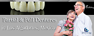 Full and Partial Dentures in Los Algodones, Mexico