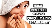 How to Remove Pimple Marks And Acne Marks From Face?