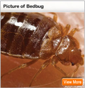 Bed Bugs Bites, Signs, in Hotels, Treatment, Symptoms - MedicineNet