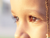 Nystagmus: prevention and cure