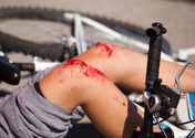 Bicycle Accidents and You