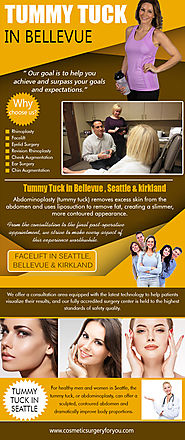 Tummy Tuck in Bellevue