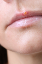 How To Cure Cold Sores With Essential Oils