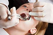 Tooth Extraction Methods