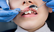 What to Do If Your Child Has Sensitive Teeth