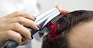 العلاج بالليزر منخفض المستوى: طريقة مبتكرة لعلاج تساقط الشعر