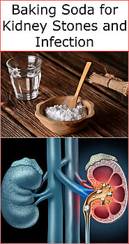 Baking Soda for Kidney Stones and Infection | Baking Soda Uses and DIY Home Remedies.