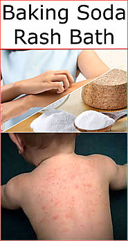 Baking Soda Rash Bath | Baking Soda Uses and DIY Home Remedies.