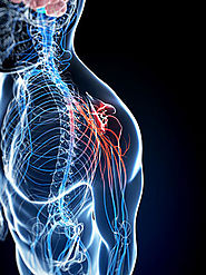 Nerve Damage After Car Accident