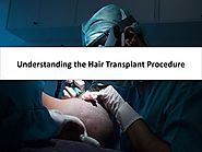 Understanding the Hair Transplant Procedure