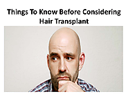 Things To Know Before Considering Hair Transplant