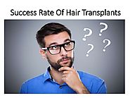 Success Rate Of Hair Transplants
