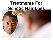 Treatments For Genetic Hair Loss