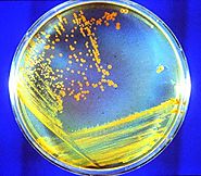 Deinococcus radiodurans NEU2012 - microbewiki