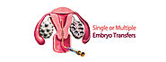 Embryo Transfer-Things To Know About It