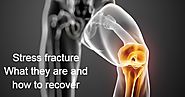 Best Orthopedic In Chennai: Stress Fracture: What They Are And How To Recover