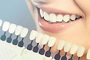 Blanqueamiento dental, ¿Cómo funciona? - comoblanqueardientes.org